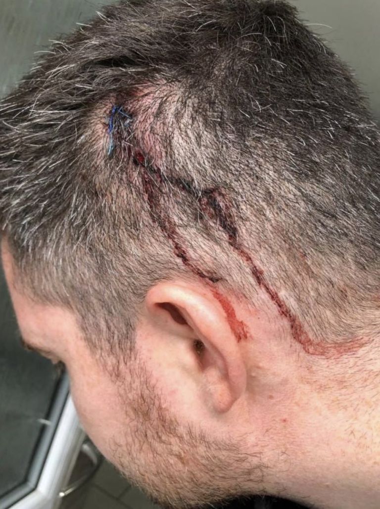 Celtic physio Daniel Friel 