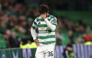 Marcelo Saracchi of Celtic goes off injured